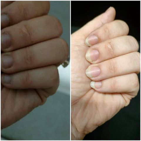 Dưỡng Móng Độc Quyền Thiên Di - Phục Hồi Móng Yếu, Giúp Móng Dài, Khỏe, Bóng Mượt với Thành Phần Thiên Nhiên An Toàn
