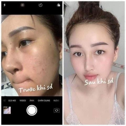 Combo Kem Dưỡng Trắng Da MEIDUZI Xanh Đỏ - Kem Mờ Thâm Sạm Nám Chống Nắng Nhật Bản hàng hiệu