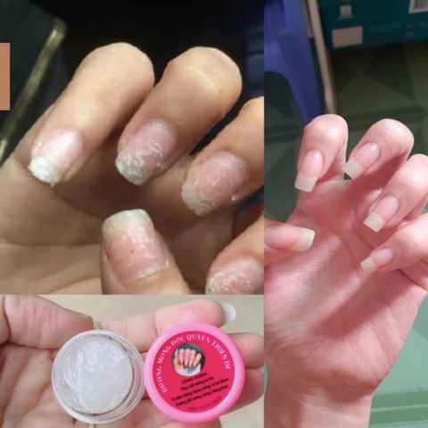 Combo 10 Hũ Dưỡng Móng Collagen - Dưỡng Móng Cứng, Nhanh Dài, Phục Hồi Móng Yếu Cho Tiệm Nail, An Toàn, Hiệu Quả