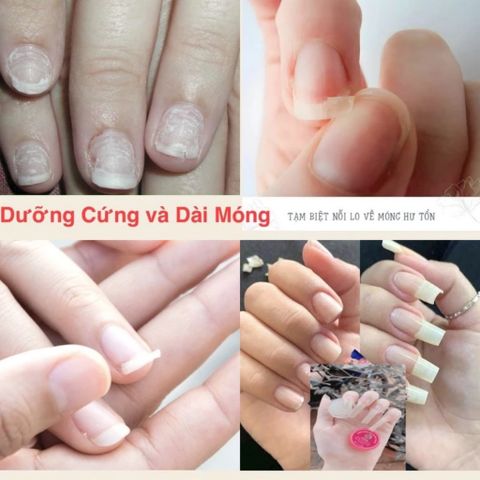 Combo 10 Hũ Dưỡng Móng Collagen - Dưỡng Móng Cứng, Nhanh Dài, Phục Hồi Móng Yếu Cho Tiệm Nail, An Toàn, Hiệu Quả