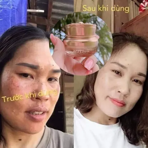Kem Nám Tàn Nhang Saffron Hải Âu Việt - Chống Nám, Mờ Thâm, Dưỡng Trắng Da, Chiết Xuất Tự Nhiên 15gr