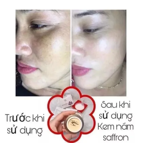 Kem Nám Tàn Nhang Saffron Hải Âu Việt - Chống Nám, Mờ Thâm, Dưỡng Trắng Da, Chiết Xuất Tự Nhiên 15gr