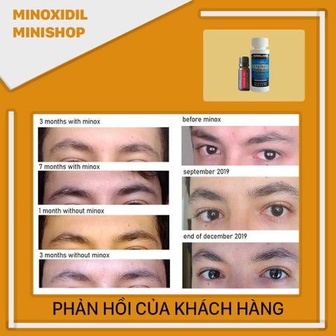 Dung Dịch Mọc Lông Mày Nam Combo Mino 5% Lỏng, Castor Oil