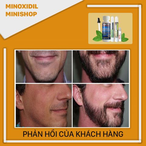 Combo Mọc Râu Tóc Nhanh Minoxidil 5% Dạng Lỏng + LCLT + Retinol + Peo 1,2ml - Bộ Chăm Sóc Da Mặt Mỹ Phẩm Chất Lượng