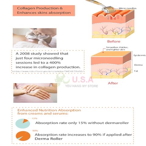 Lăn Kim ZGTS 192 Micro Needles Derma Roller 0.5mm - Giải Pháp Chăm Sóc Da Hiệu Quả Tại Nhà, Stimulator Collagen và Tăng Cường Hấp Thụ Dưỡng Chất