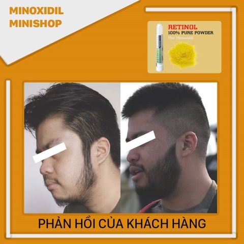 Retinol Tăng Cường Mọc Râu - Bột Vitamin A Pure Powder Hỗ Trợ Phát Triển Nang Lông Hiệu Quả