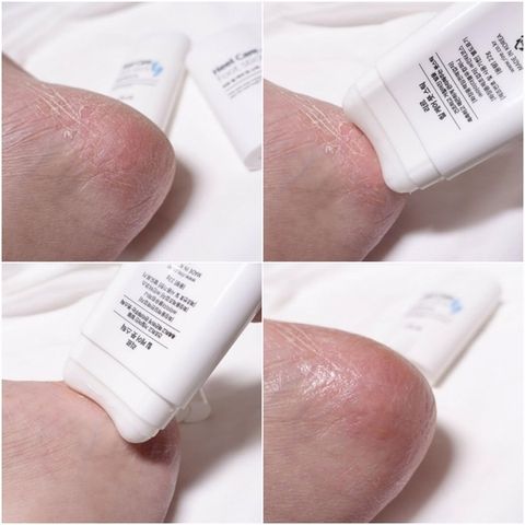 Thanh Lăn Dưỡng Ẩm Rire 22g - Phục Hồi Gót Chân Khô Ráp, Nứt Nẻ, Chăm Sóc Da Chân Hiệu Quả, Dễ Sử Dụng