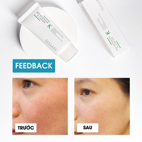 Kem dưỡng Vitamin K Cream Usolab 50ml làm dịu, phục hồi da nhạy cảm và căng bóng da