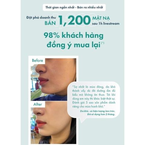 Mặt Nạ Dưỡng Da B5 OMUSE Aquaporin Mask 30g Cấp Ẩm Và Phục Hồi Da [ Chính Hãng ]