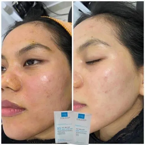 Mặt nạ mask B5 Yuejin phục hồi cấp ẩm dịu da [ Nhập Khẩu Chính Hãng ]