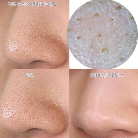 Mặt Nạ Đất Sét INNISFREE Super Volcanic Pore Clay Mask 2X 357561