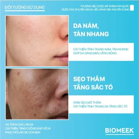 Tinh chất Tranexide Biomeek Serum hỗ trợ dưỡng sáng, mờ thâm 30ml