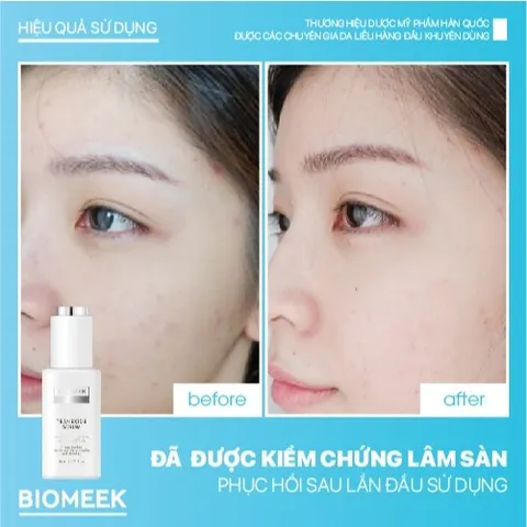 Tinh chất Tranexide Biomeek Serum hỗ trợ dưỡng sáng, mờ thâm 30ml