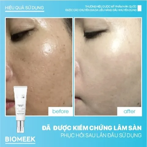 Kem dưỡng Tranexide Biomeek Cream dưỡng sáng, mờ thâm 50ml