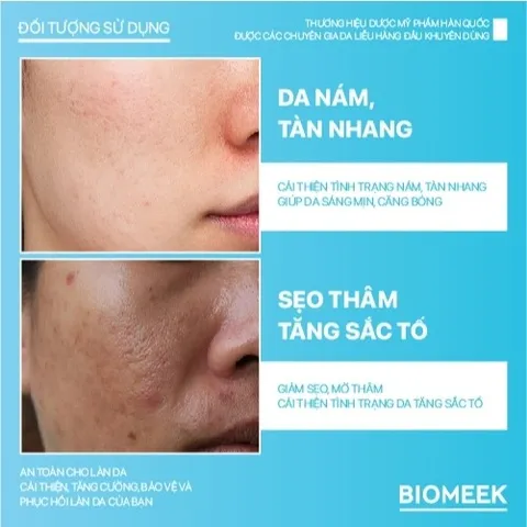 Kem dưỡng Tranexide Biomeek Cream dưỡng sáng, mờ thâm 50ml
