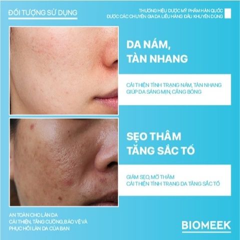 Combo serum và cream Biomeek Tranexide, hỗ trợ dưỡng sáng, mờ thâm (30ml và 50ml)