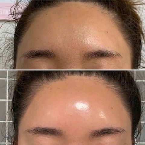 Kem Dưỡng Chống Lão Hoá Làn Da Obagi Retinol 0.5 Và Retinol 1.0