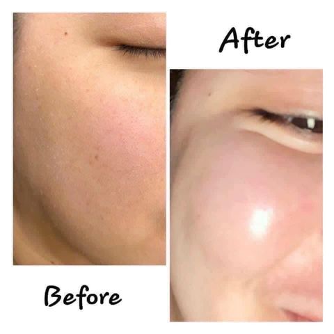 Kem Dưỡng Chống Lão Hoá Làn Da Obagi Retinol 0.5 Và Retinol 1.0