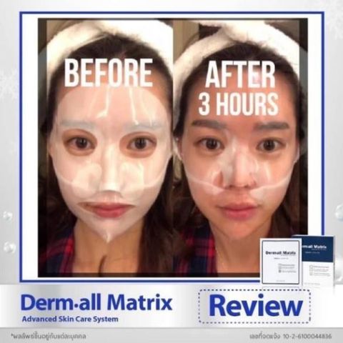 Mặt Nạ Derm all Matrix Mẫu Mới Nhất ( Hộp 4 Miếng )