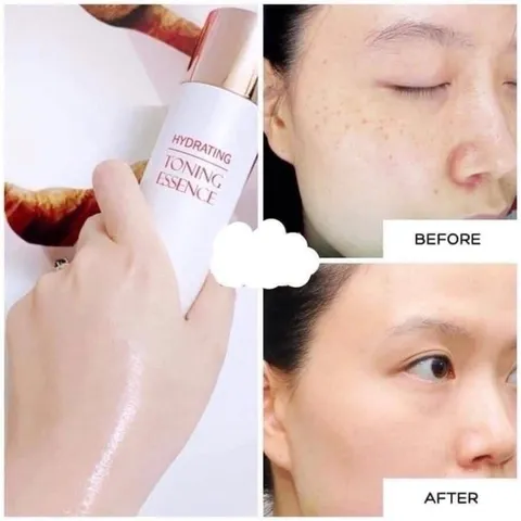 Nước Thần Huyết Tơ Tằm Hydrating Toning Essence 150ml