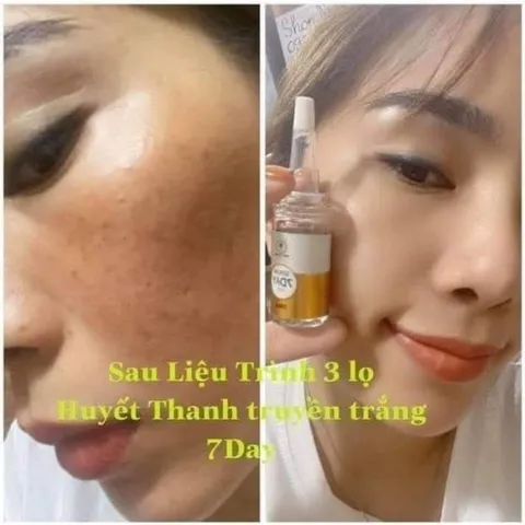 Huyết thanh truyền trắng 7day Olic/Serum 7day Olic trắng da mờ nám dưỡng ẩm Chính Hãng