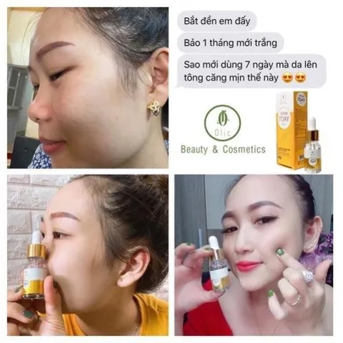 Huyết thanh truyền trắng 7day Olic/Serum 7day Olic trắng da mờ nám dưỡng ẩm Chính Hãng