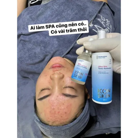 ICON SKIN Peel da 18% Anti-acne Smart Peel không bong 30ml