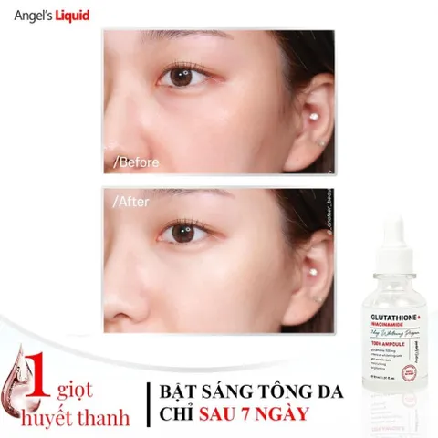 Bộ 3 sản phẩm Nước thần, Huyết thanh, Kem dưỡng mờ nám, dưỡng trắng Angel Liquid Glutathione Plus Niacinamide
