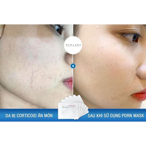 Mặt nạ tế bào gốc USOLAB - PDRN MASK 30ml