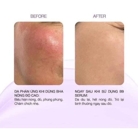 Serum B9 Vic Derma Folic Acid Phục Hồi Trẻ Hóa Vicderma 50ML