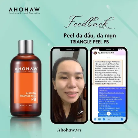 Dung Dịch Ahohwa Triangle Peel Pb Peel Dành Cho Da Dầu 80ml
