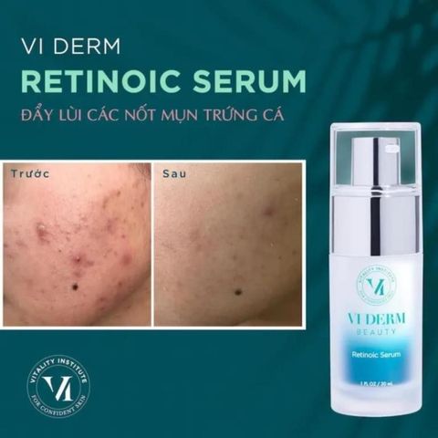 Vi Derm Beauty Retinoic Serum RX Tinh Chất Trẻ Hóa Da, Giảm Mụn 30ml Viderm