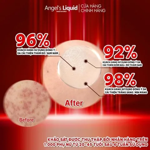 Siêu Tinh Chất Xoá Thâm Đỏ Mờ Sạm Nám Angel's Liquid Tranexamic Mela Ampoule 30ml [ Chính Hãng ]