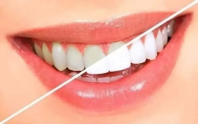 Kem Đánh Răng ODOL Med 3 - Công Thức 3 Trong 1 Ngừa Sâu Mịn Răng, Bảo Vệ Nướu, Hơi Thở Thơm Mát - Hàng Nhập Khẩu UK