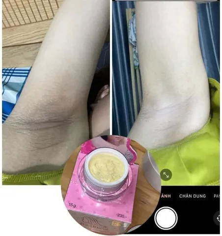 Kem Q-NIC Care 15g - Giảm Thâm Nách, Đầu Gối, Khuỷu Tay - Đặc Trị Da Trắng Sáng, Glutathione & Sữa Non, Chính Hãng Thái Lan