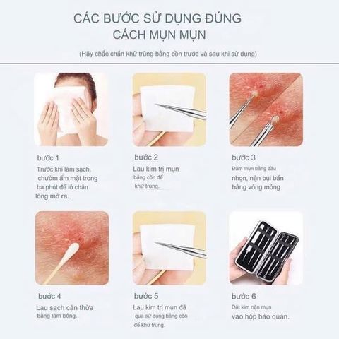 Bộ Dụng Cụ Nặn Mụn Chuyên Nghiệp JPNK Pro - Thép Không Gỉ An Toàn, Giúp Làm Sạch Da Mịn Màng, Tiện Lợi Mang Theo