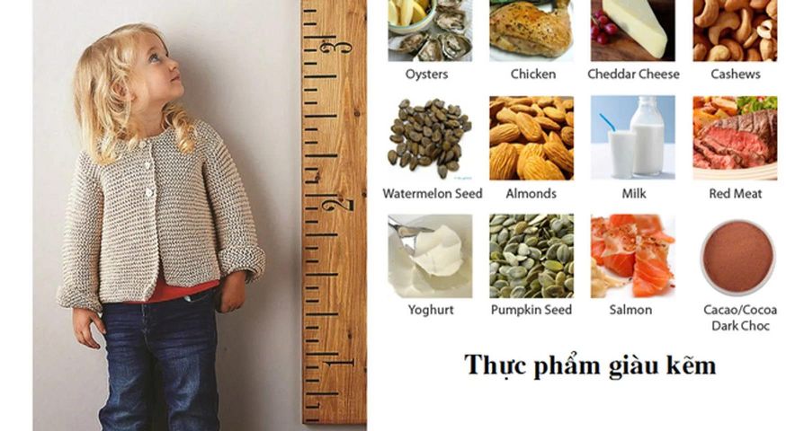 Siro ChildLife Calcium & Magnesium Vị Cam - Vitamin Tổng Hợp Hỗ Trợ Phát Triển Xương Cho Bé - Sản Phẩm Chất Lượng Từ Mỹ