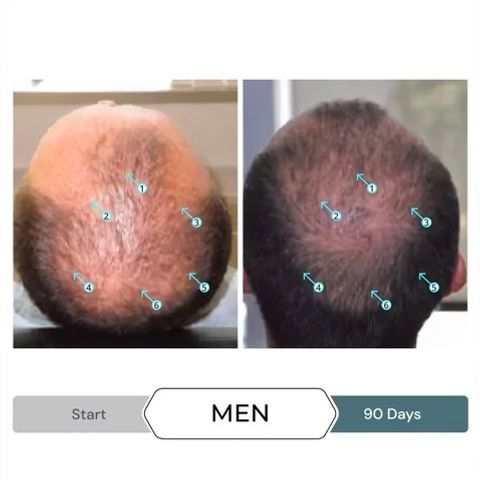 Serum Kích Thích Mọc Tóc SPECTRAL.F7 60ml - Giảm Gãy Rụng Tóc Cho Nam Nữ, Tăng Cường Độ Dày và Đầy Đặn Tóc