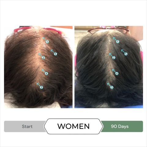 Serum Tăng Mọc Tóc Spectral.CBD 60ml - Giảm Rụng, Gàu & Kích Thích Mọc Tóc Dày Đầy, Công Nghệ Nanosome Mỹ