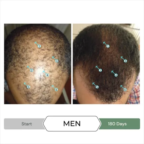 Serum Tăng Mọc Tóc Spectral.CBD 60ml - Giảm Rụng, Gàu & Kích Thích Mọc Tóc Dày Đầy, Công Nghệ Nanosome Mỹ