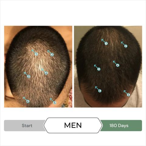 Serum Tăng Mọc Tóc Spectral.CBD 60ml - Giảm Rụng, Gàu & Kích Thích Mọc Tóc Dày Đầy, Công Nghệ Nanosome Mỹ