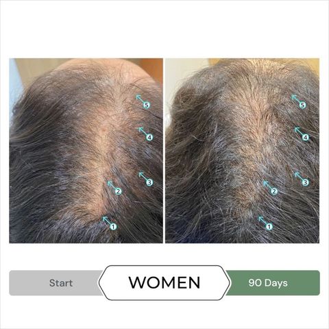 Combo Dầu Gội Xả Revita.CBD & NIA - Kích Thích Mọc Tóc, Ngăn Ngừa Gãy Rụng, Dưỡng Tóc Khỏe Mạnh - Chăm Sóc Tóc Hư Tổn