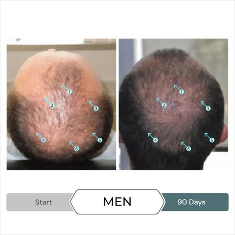 Serum kích thích mọc tóc SPECTRAL.F7 60ml - Giải pháp cho tóc mỏng và gãy rụng từ Ds Laboratories cho cả nam nữ