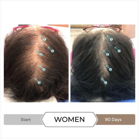 Serum Kích Thích Mọc Tóc SPECTRAL.DNC-N 60ml - Giảm Rụng Tóc, Tăng Mật Độ và Độ Dày Tóc, Công Thức Nanosome Hàng Đầu Mỹ