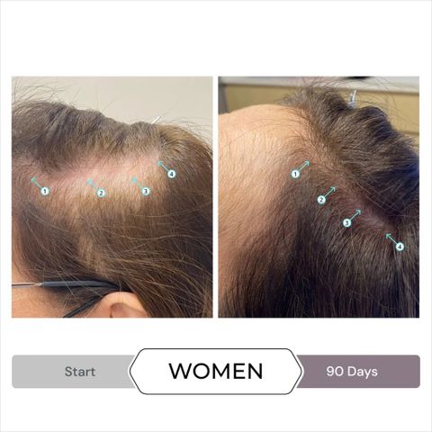 Serum Kích Thích Mọc Tóc SPECTRAL.CSF 60ml Dành Cho Phụ Nữ - Giảm Rụng Tóc và Tăng Mật Độ Tóc Khỏe Mạnh, DS Laboratories
