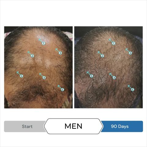 Serum Kích Thích Mọc Tóc Spectral UHP 60ml - Giảm Gãy Rụng, Thúc Đẩy Tăng Trưởng Tóc Cho Nam DS Laboratories
