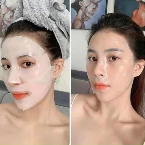 Mặt Nạ Derm All Matrix Hàn Quốc - Bộ 4 Miếng Cung Cấp Độ Ẩm và Làm Mềm Da - Sản Phẩm Chăm Sóc Da Đẹp Tự Nhiên