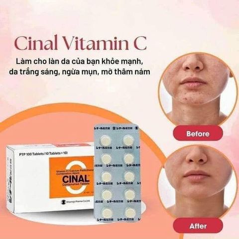 Viên Uống Cinal C 100 Viên Chính Hãng Nhật Bản – Thực Phẩm Bổ Sung Vitamin C, Hỗ Trợ Làm Sáng Da, Chăm Sóc Sắc Đẹp