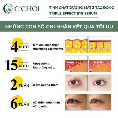 Tinh Chất Dưỡng Mắt 3 Tác Động C’Choi - Triple Effect Eye Serum Giảm Thâm Quầng, Bọng Mắt, Nếp Nhăn Cho Da Khỏe Mạnh