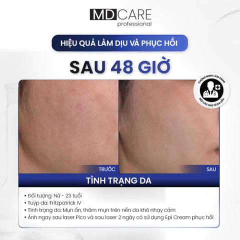 Kem Dưỡng Ẩm Phục Hồi Nếp Nhăn MD Care Epi-ProCare Cream - Dưỡng Ẩm, Tái Tạo Da, Giảm Thiểu Nếp Nhăn, Phù Hợp Tất Cả Loại Da
